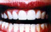 Facettes2.jpg (8328 octets)