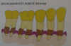 tartre2.jpg (12687 octets)